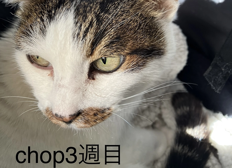 CHOP3週目ビンクリスチン