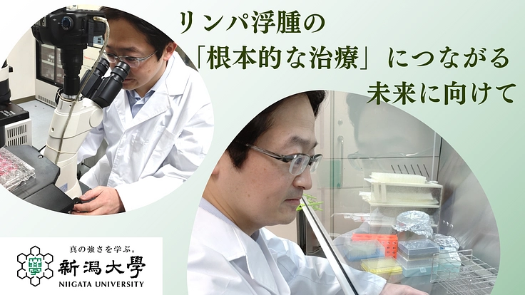 リンパ浮腫の進行を抑制する治療法開発を目指す、リンパ管の研究を！