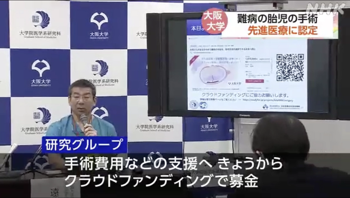 本日、大阪大学で記者会見を行いました。