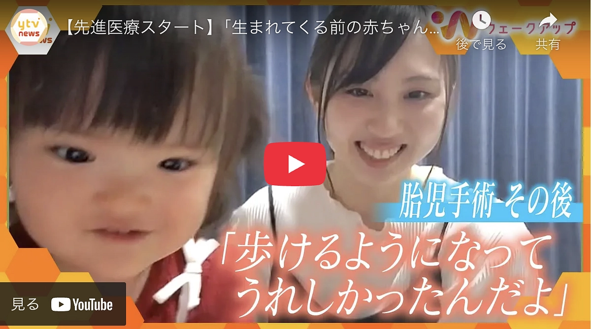 3月1日　読売テレビにて：【先進医療スタート】「生まれてくる前の赤ちゃんに手術を」【ウェークアップ】