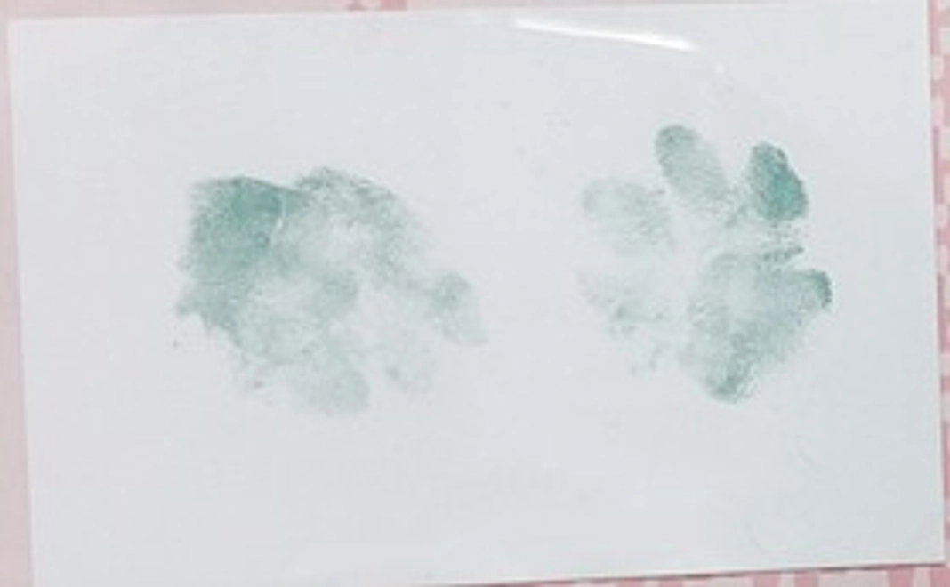 負けるな「ももちゃん」コース