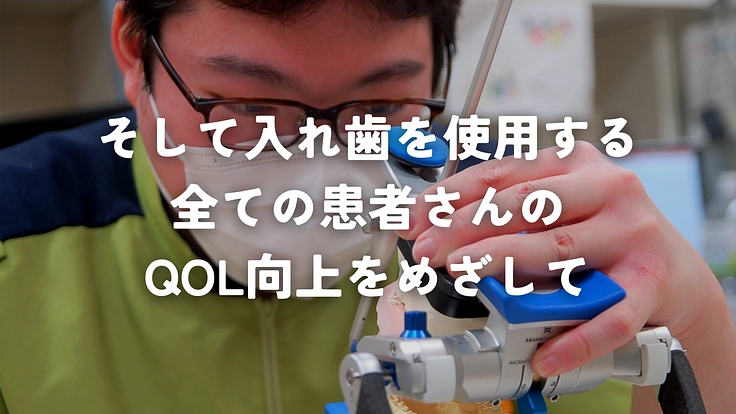 折りたたみ式入れ歯を開発し、開口障害がある方も顎義歯を使えるように 4枚目