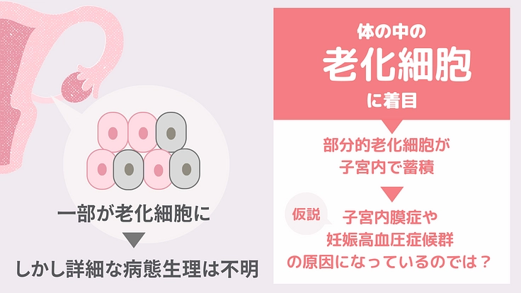 子宮内膜症と妊娠高血圧症候群の根治を目指す、治療薬の開発にご支援を 2枚目
