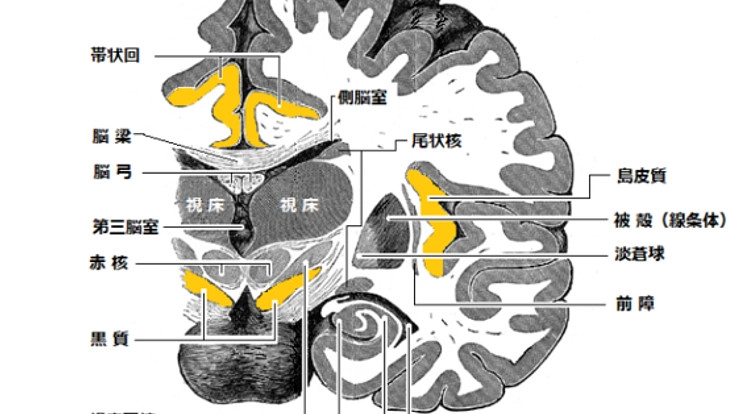 人工知能を使い パーキンソン病に悩む人達を助けたい。