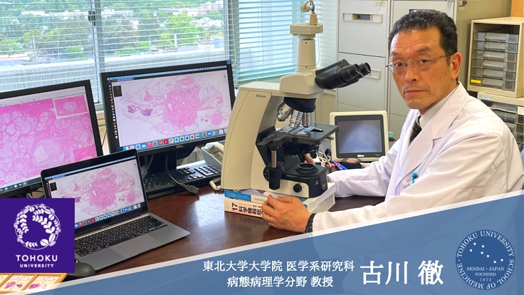 早期発見と個別治療最適化で、膵臓がんで亡くなる患者さんを減らしたい