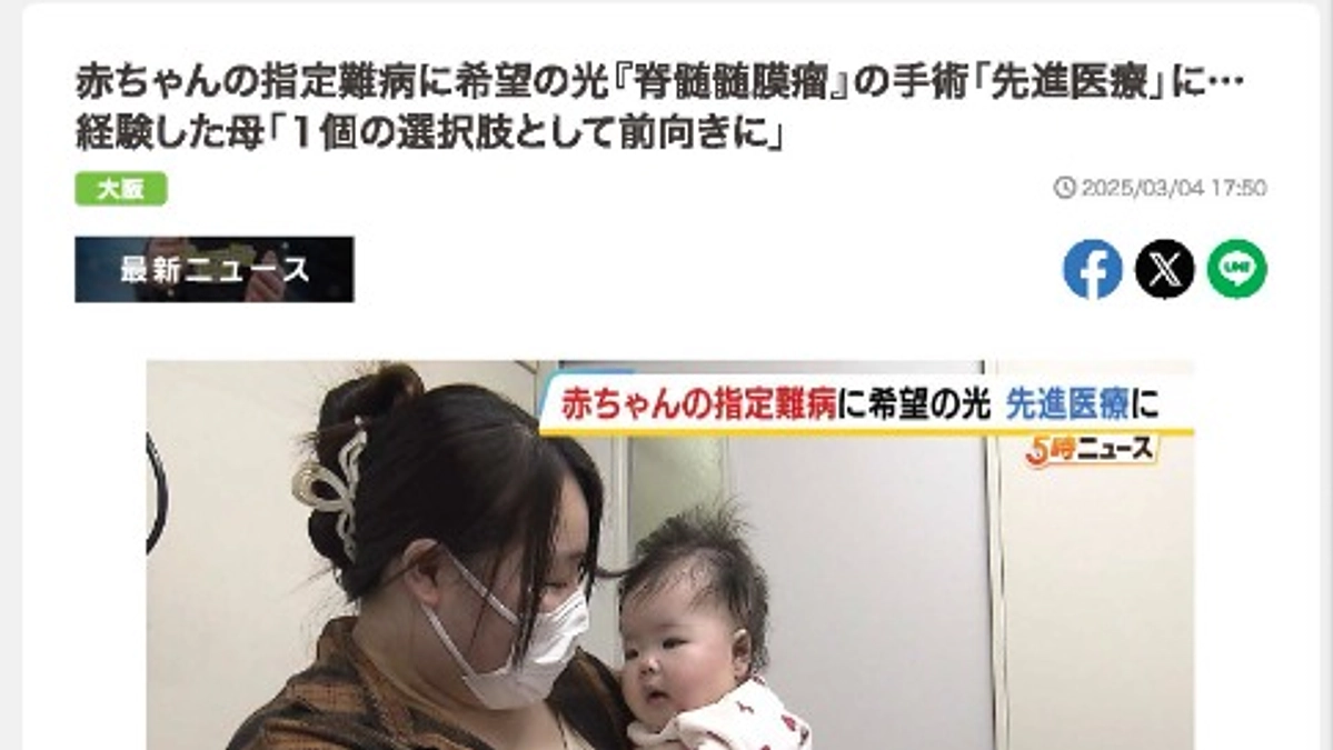 3月4日のMBSNEWSの記事です。