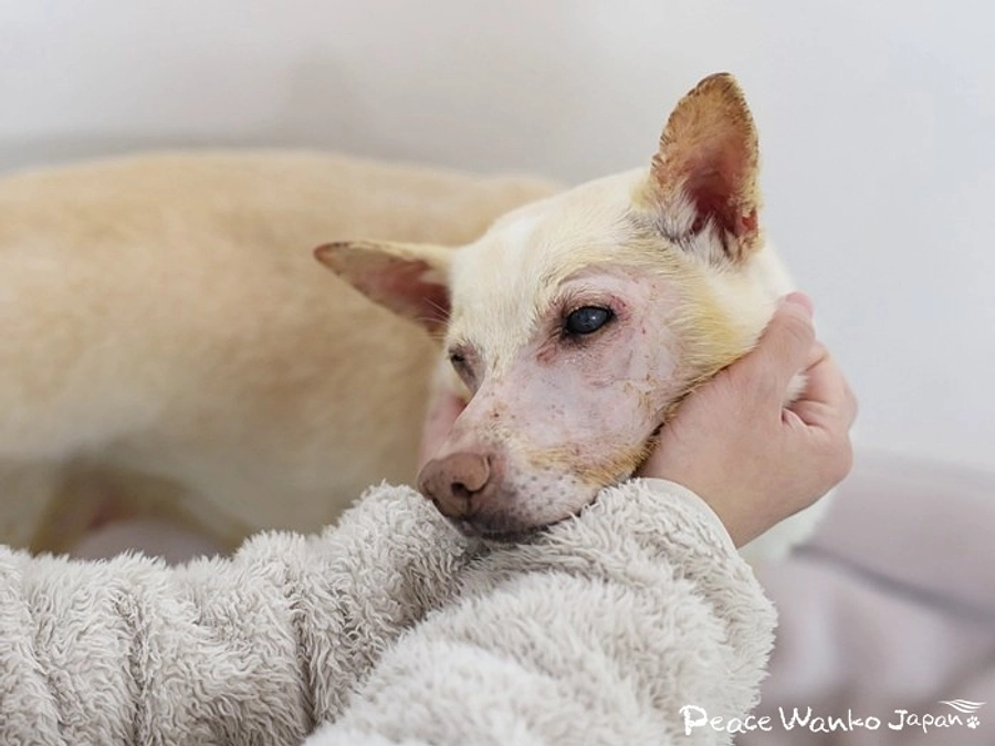 震える身体。てんかん発作と戦う「フール」