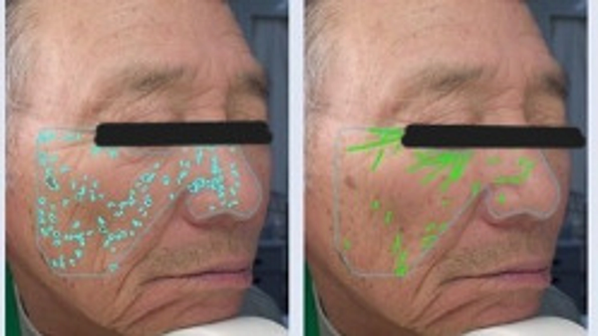 【研究成果】ふたごは顔の老化も同じもの？