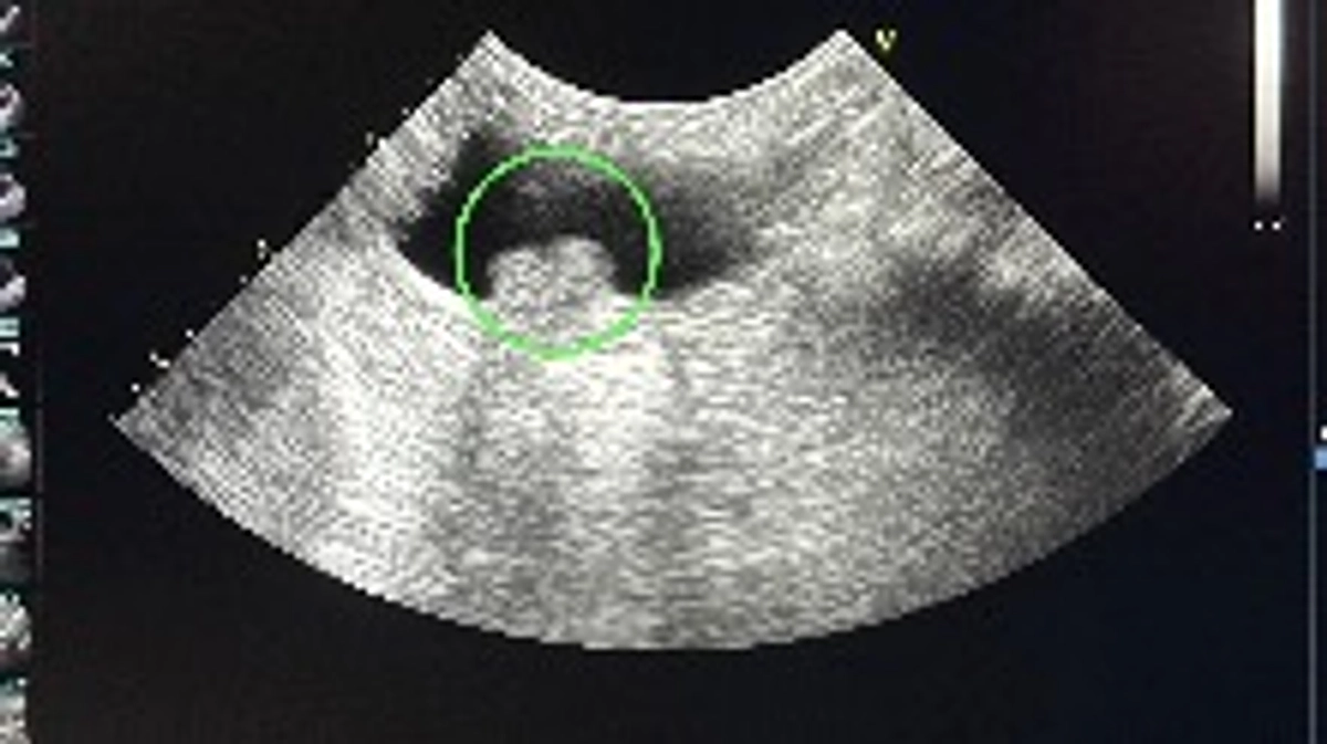 ネクストゴール設定の理由につきまして