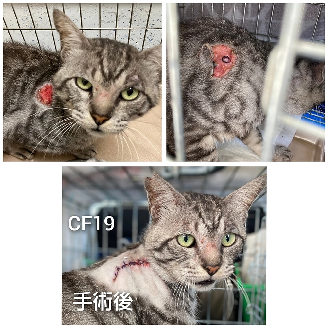 CF１９～２２手術終わりました