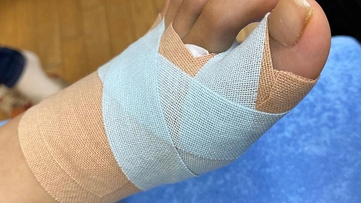 貼ったまま入浴できるテーピングの開発に成功