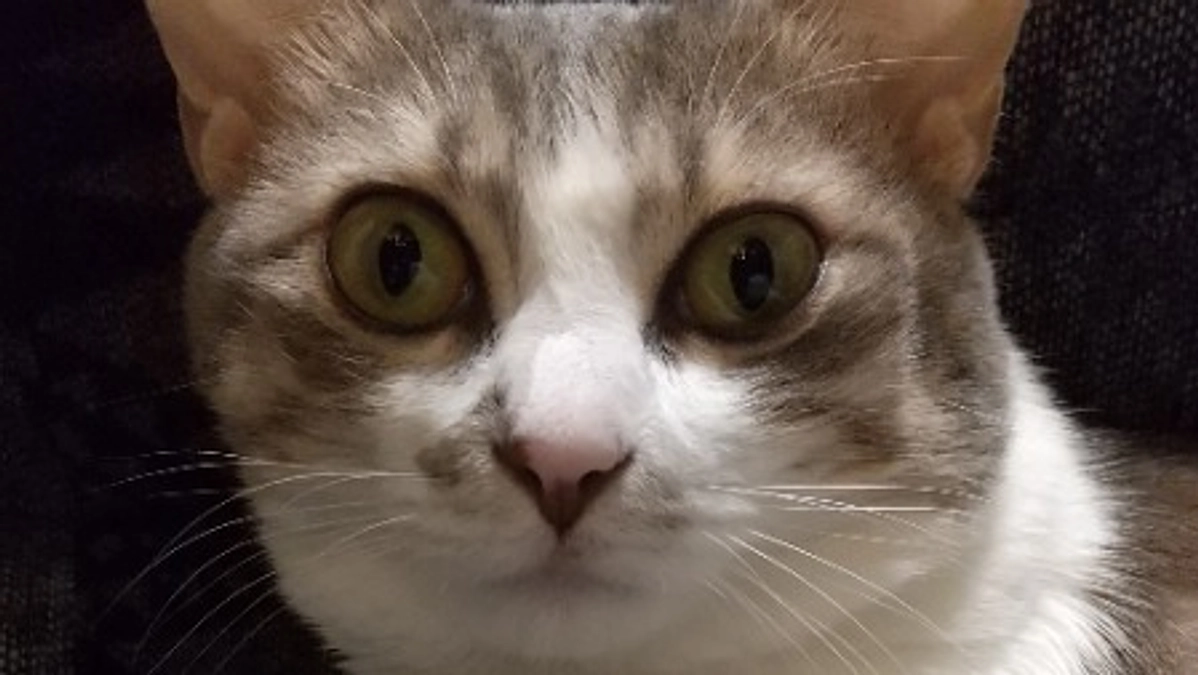 水頭症について