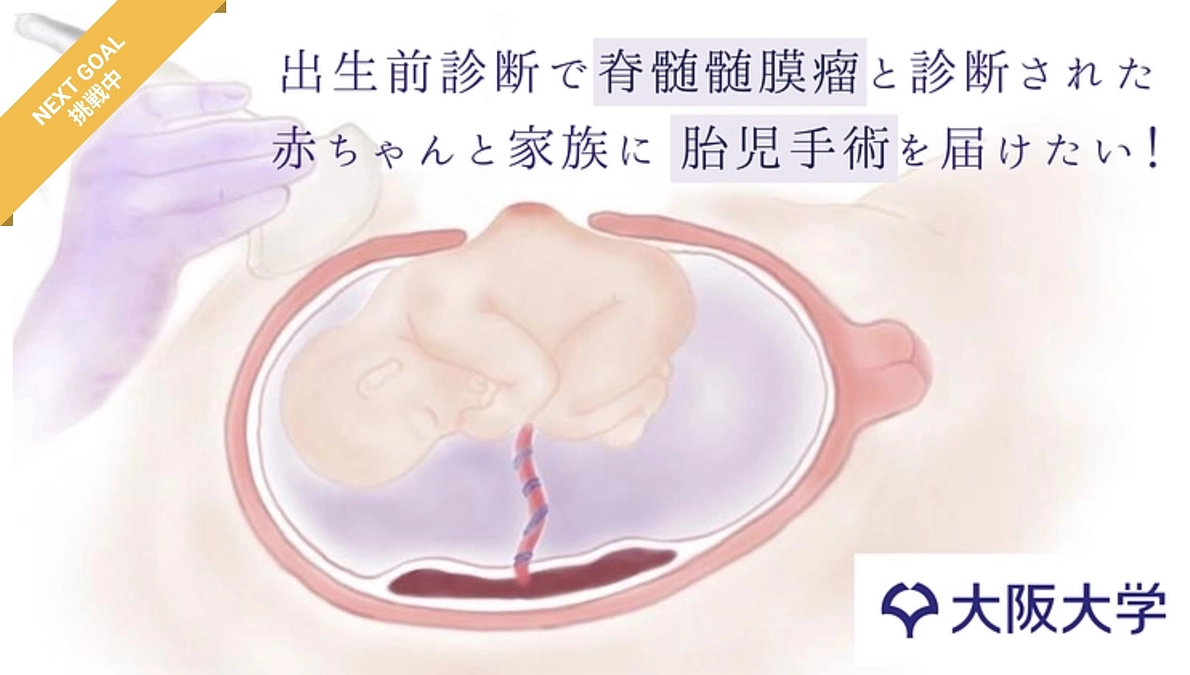 胎児手術のよもやまばなし⑤