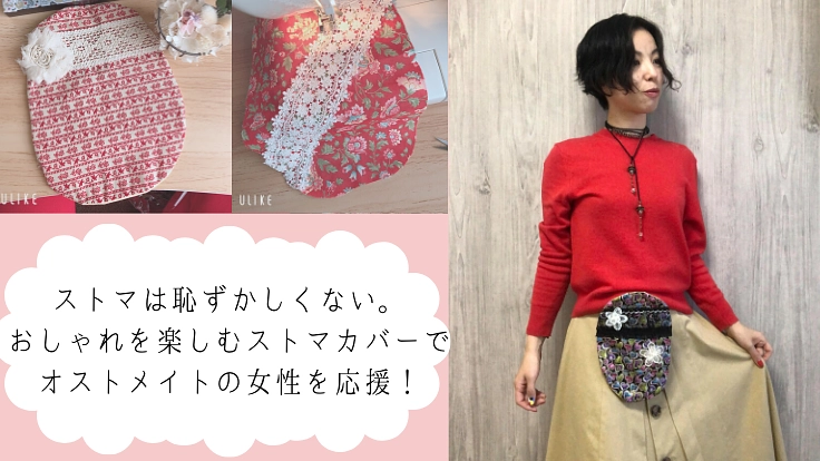 オストメイト女性に自信を。「第二のランジェリー」ストマカバー