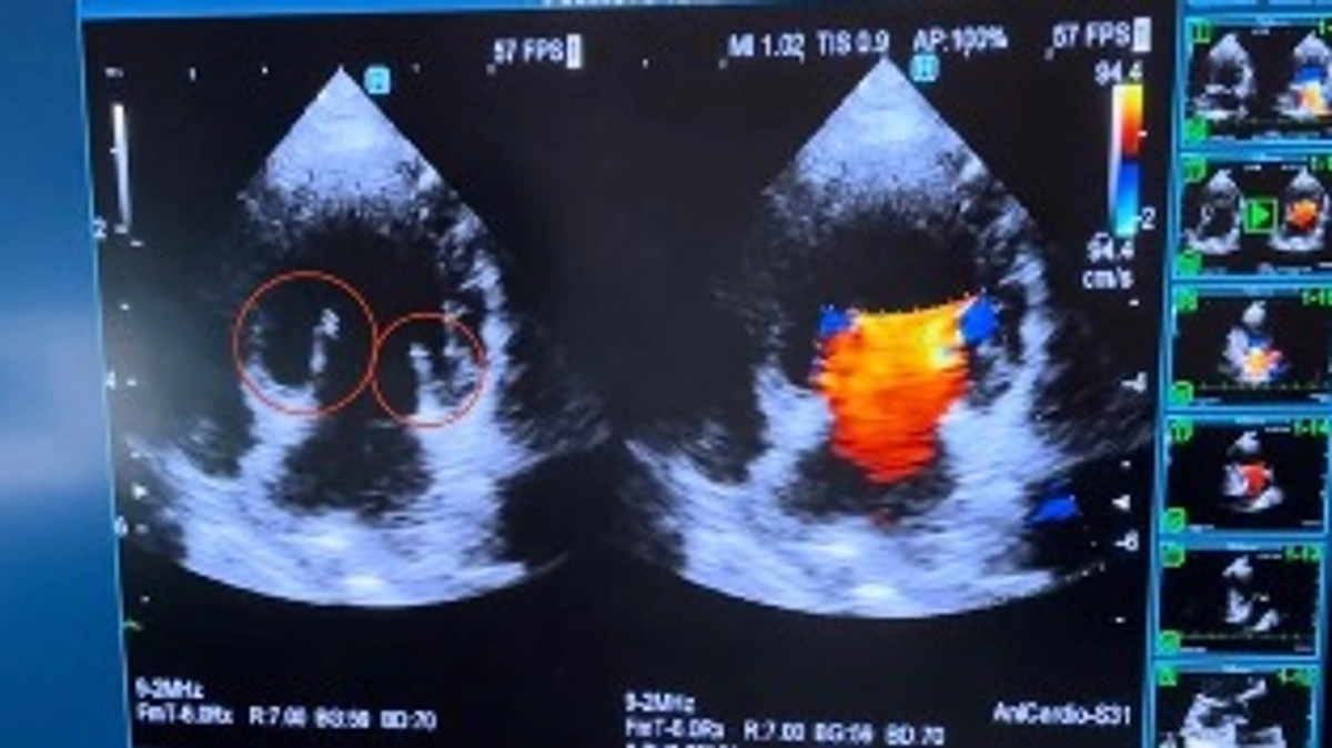 僧帽弁閉鎖不全症とは【活動報告32日目】