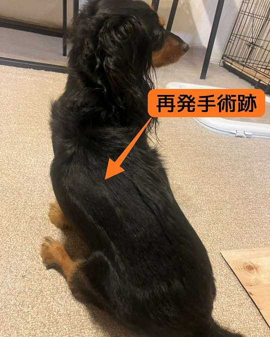 【進行性脊髄軟化症と椎間板ヘルニアとは？】