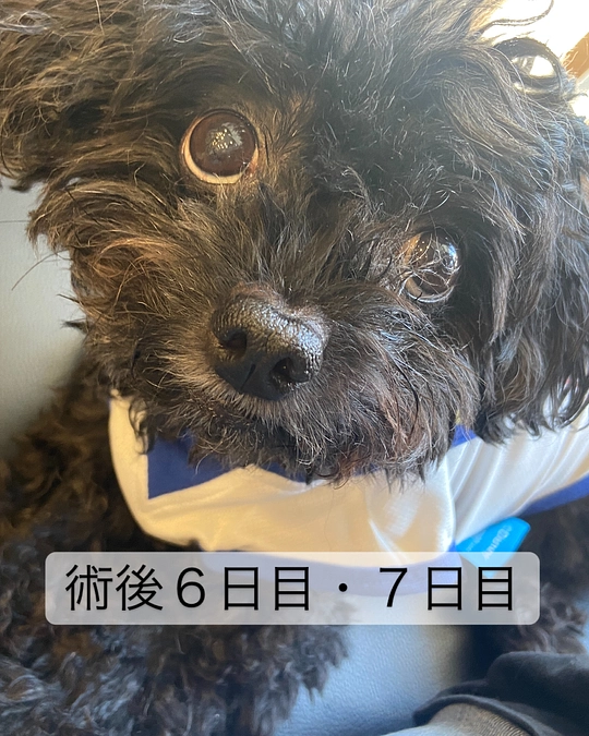 術後６日目・７日目