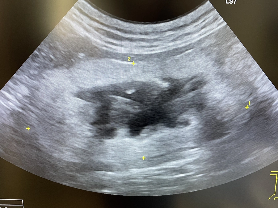 【クラファン活動報告⑭】エコー（超音波）検査機器について