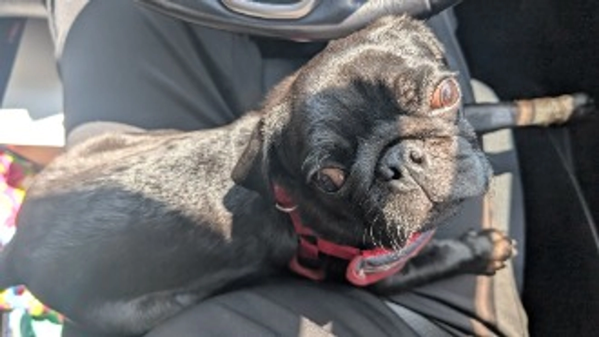 門脈シャント術前カンファレンス