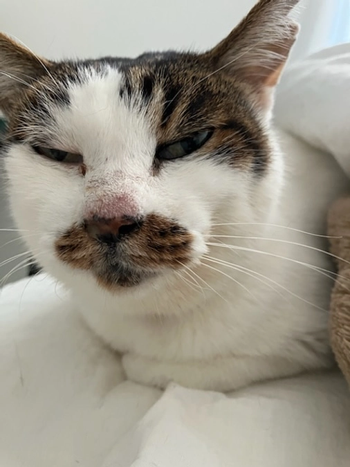 CHOP8週目ドキソルビシン