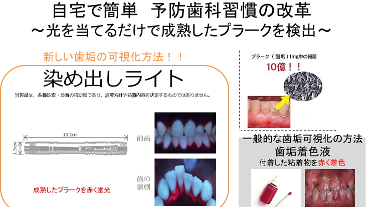 おうちで簡単に歯磨き習慣を身につける歯垢歯石検査ライト