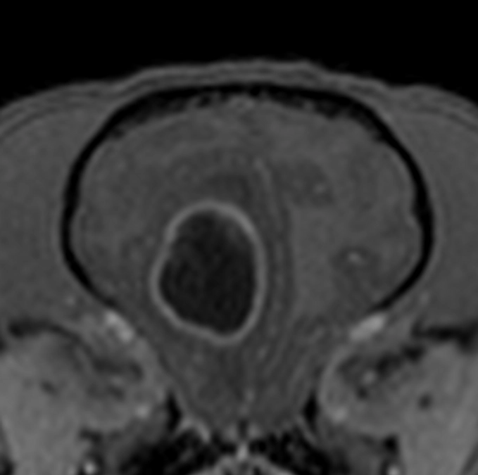 本日７例目の手術が行われました！