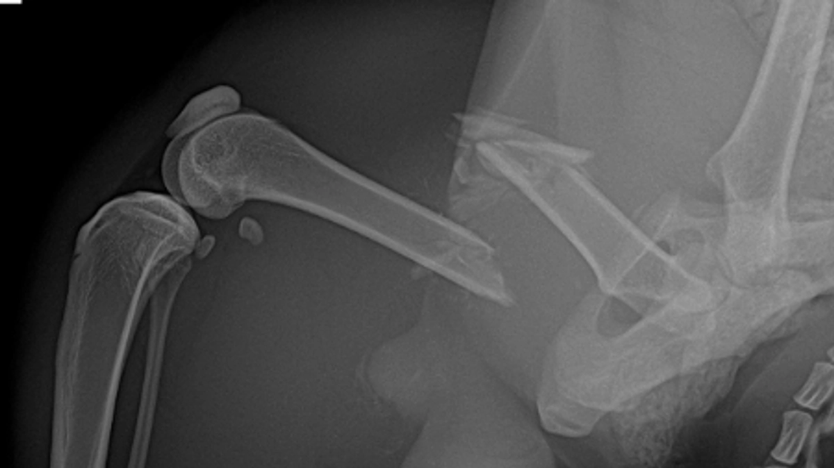 術後検診に行ってまいりました