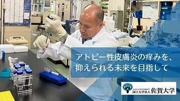 アトピー性皮膚炎｜痒みの仕組みの解明と、治療薬の開発研究にご支援を のトップ画像