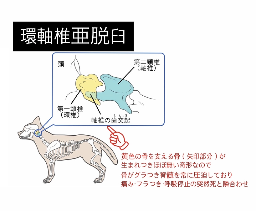 環軸椎亜脱臼と脊髄空洞症の病気部位