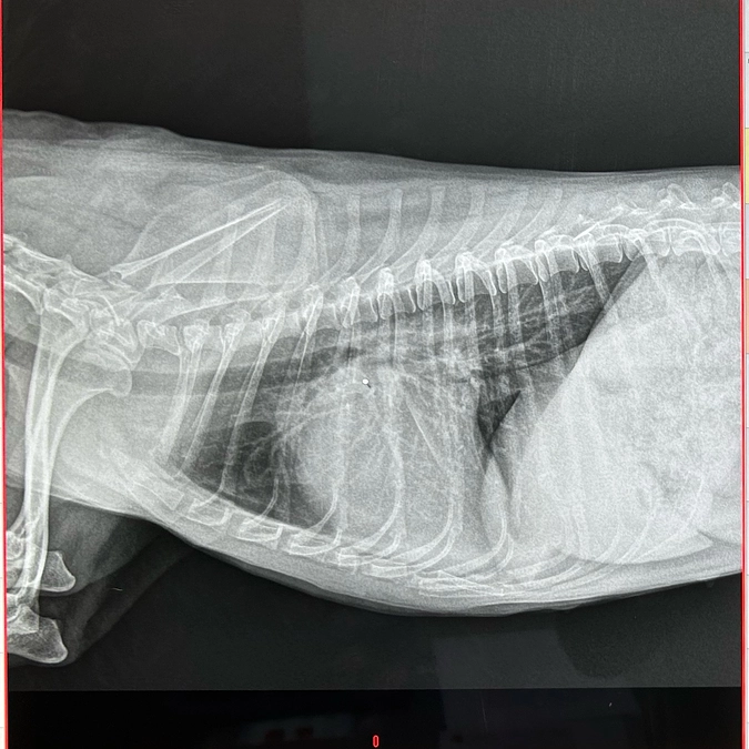 検査結果② 検査と輸血について
