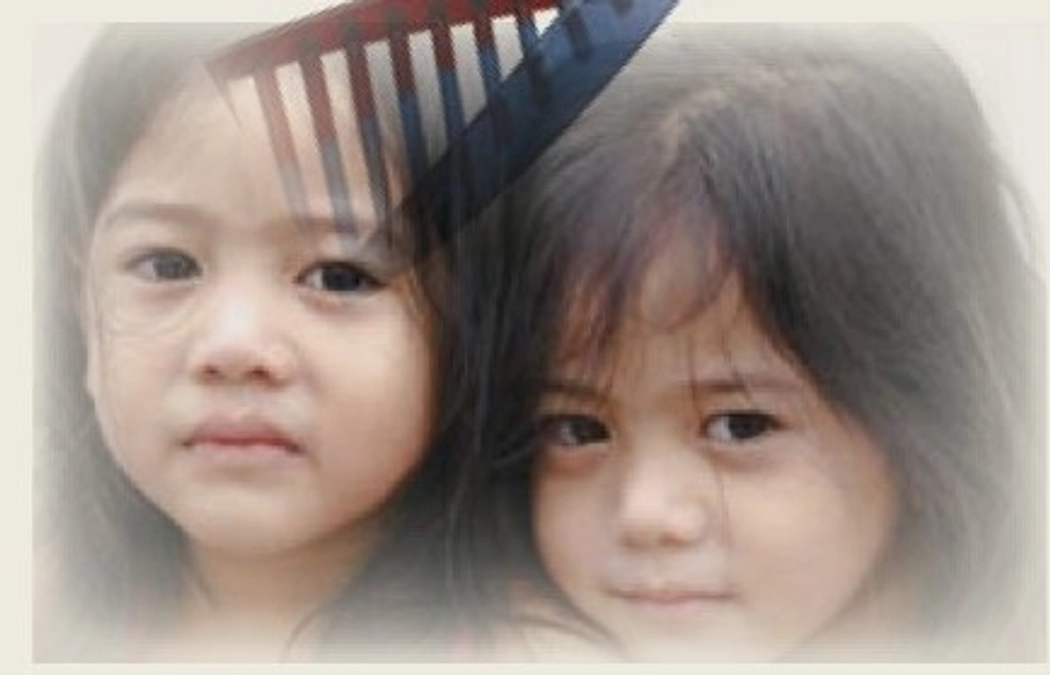 【コラム】卵性診断とは？