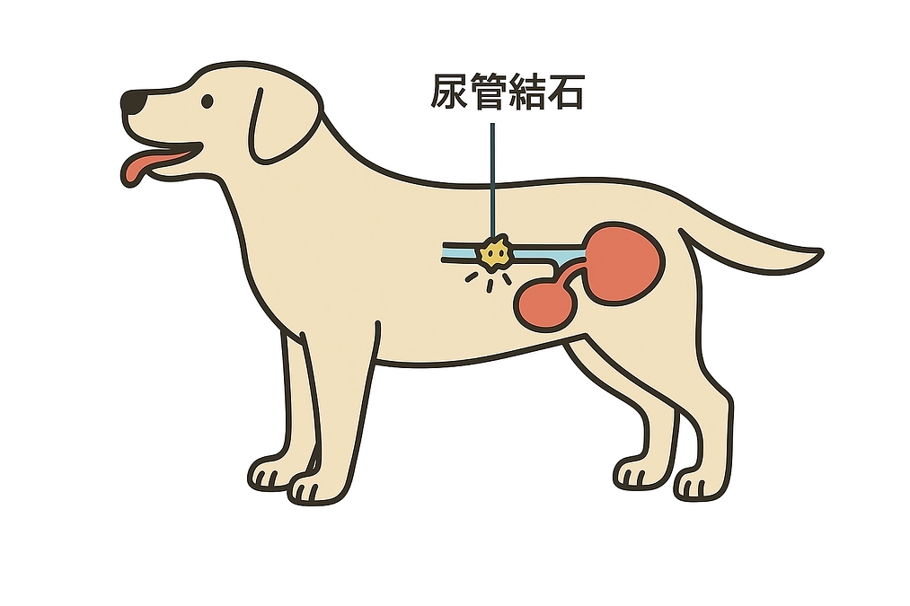 アポの病気（尿管結石）