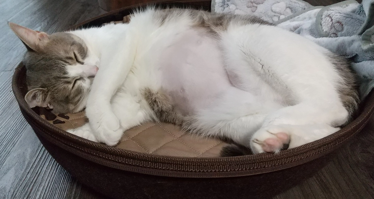 水頭症がわかるまで