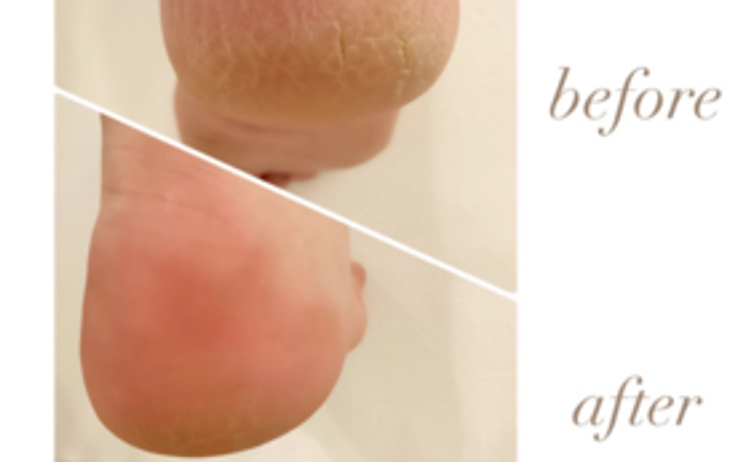 フットケアコース