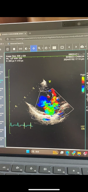 エコー画像ビフォーアフター