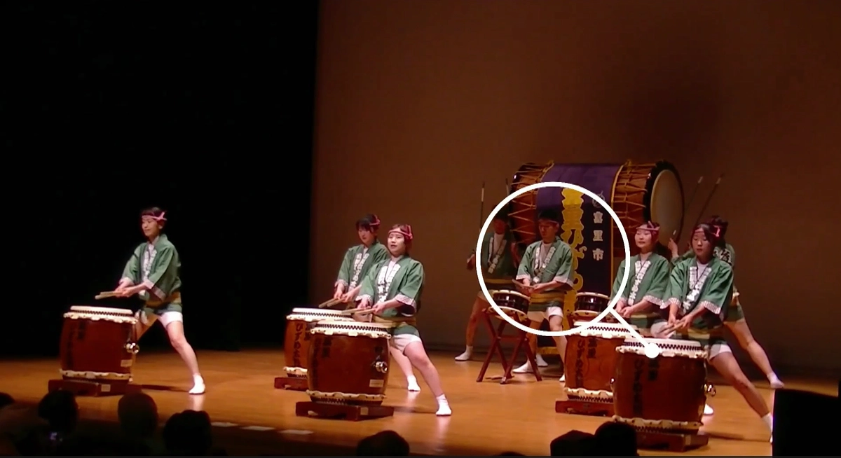 TGCV患者さんの栄養療法体験談