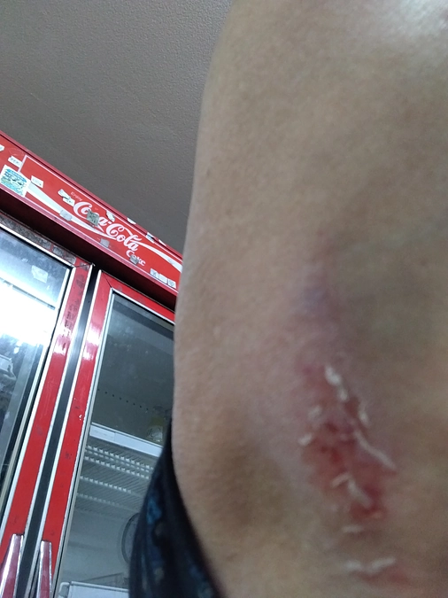 💦あいててて💦💦💦😖