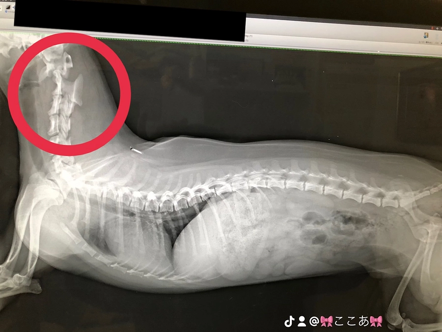 環軸推亜脱臼症と診断されて