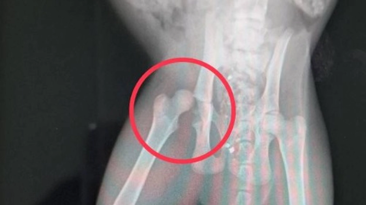 股関節脱臼のれお、ジャンプしています