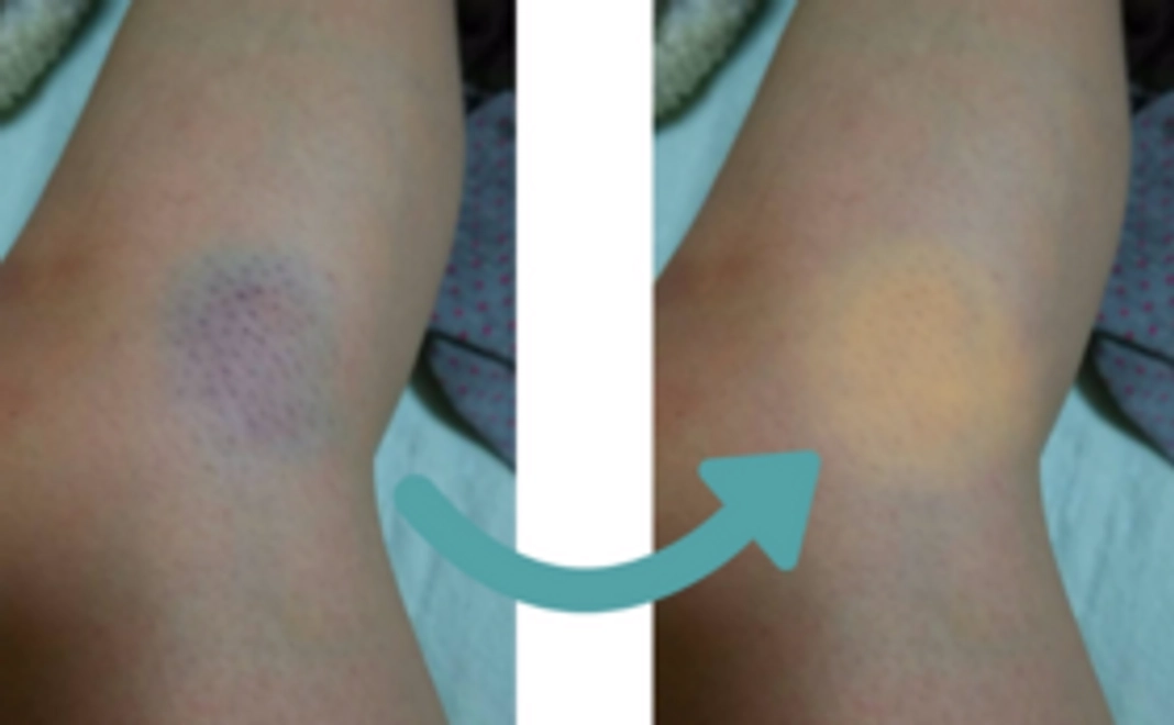 【まずは体験してみたい方！】体験1回分