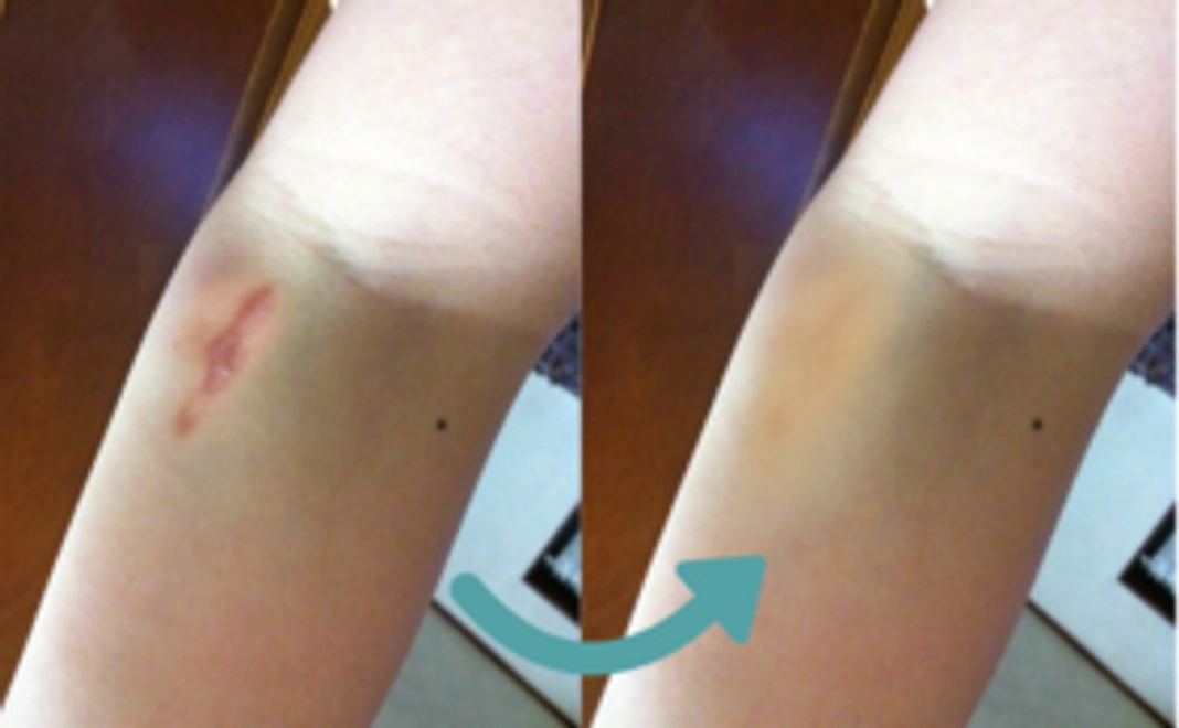 【まずは体験してみたい方！】体験3回分