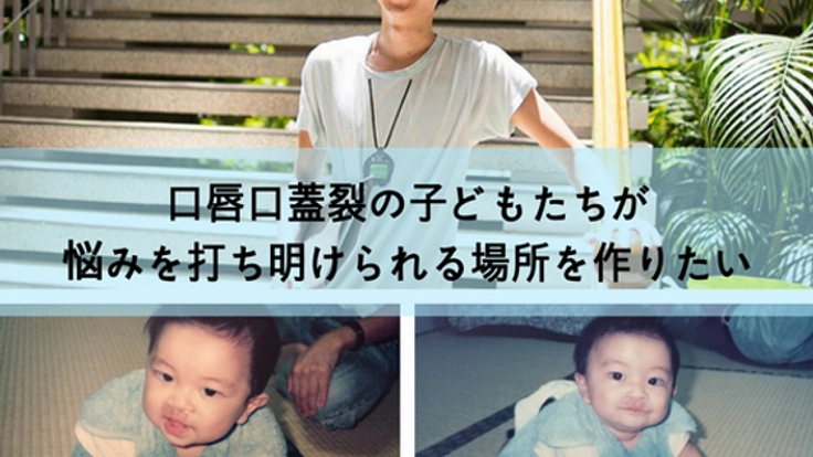 口唇口蓋裂を抱えた子どもが、安心して相談できる場所を作りたい