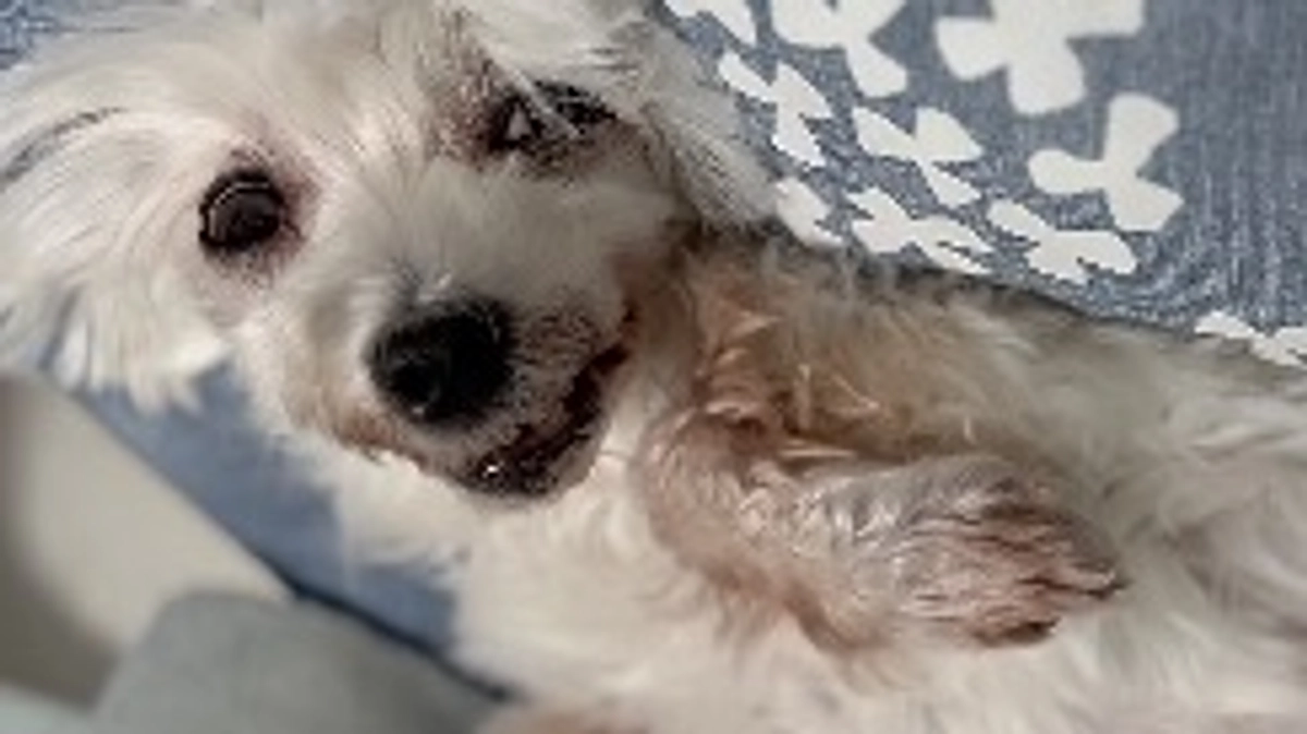 末梢神経の障害による手足の震え