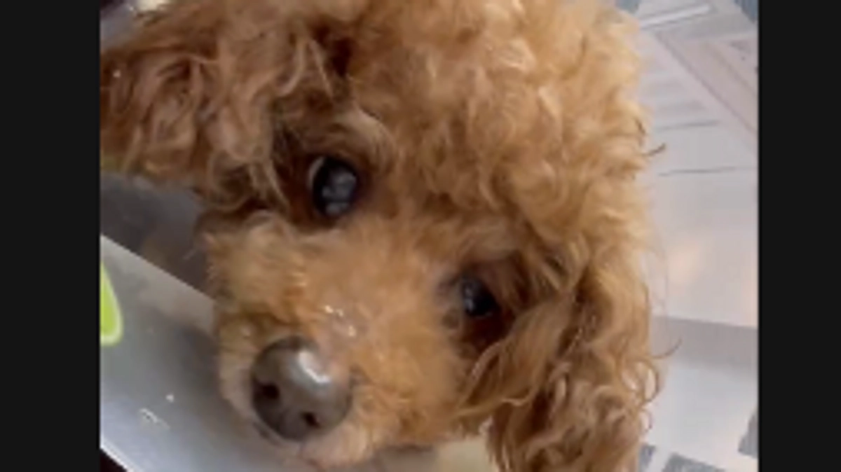 術後の脳梗塞について