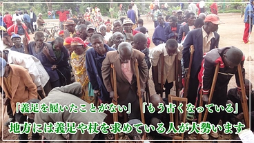 ルワンダの地方の人に義足を！強制撤去を乗り越え、巡回診療の復活へ！ のトップ画像