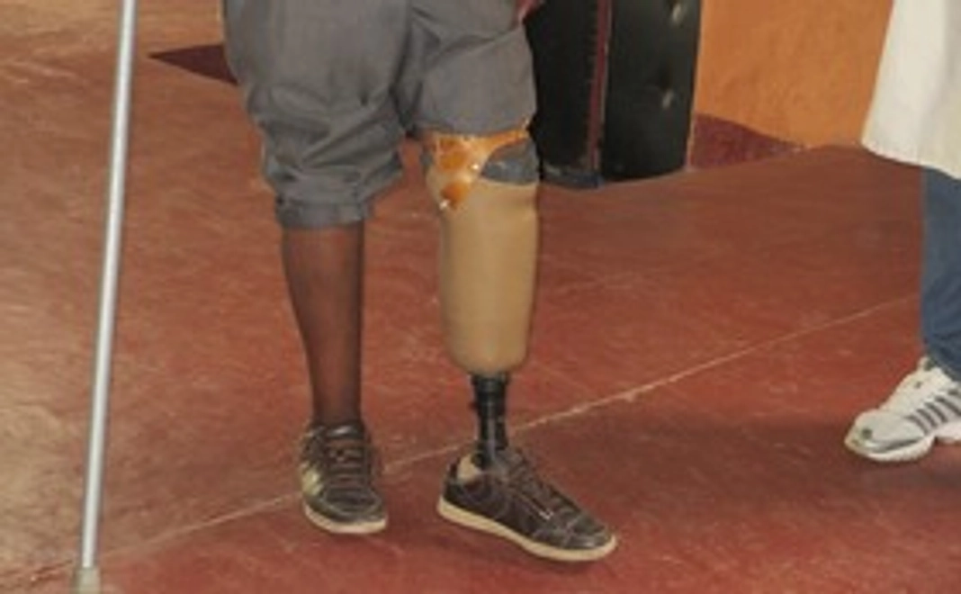 3000円膝下義足コース（居酒屋一人一回分の節約で支援）