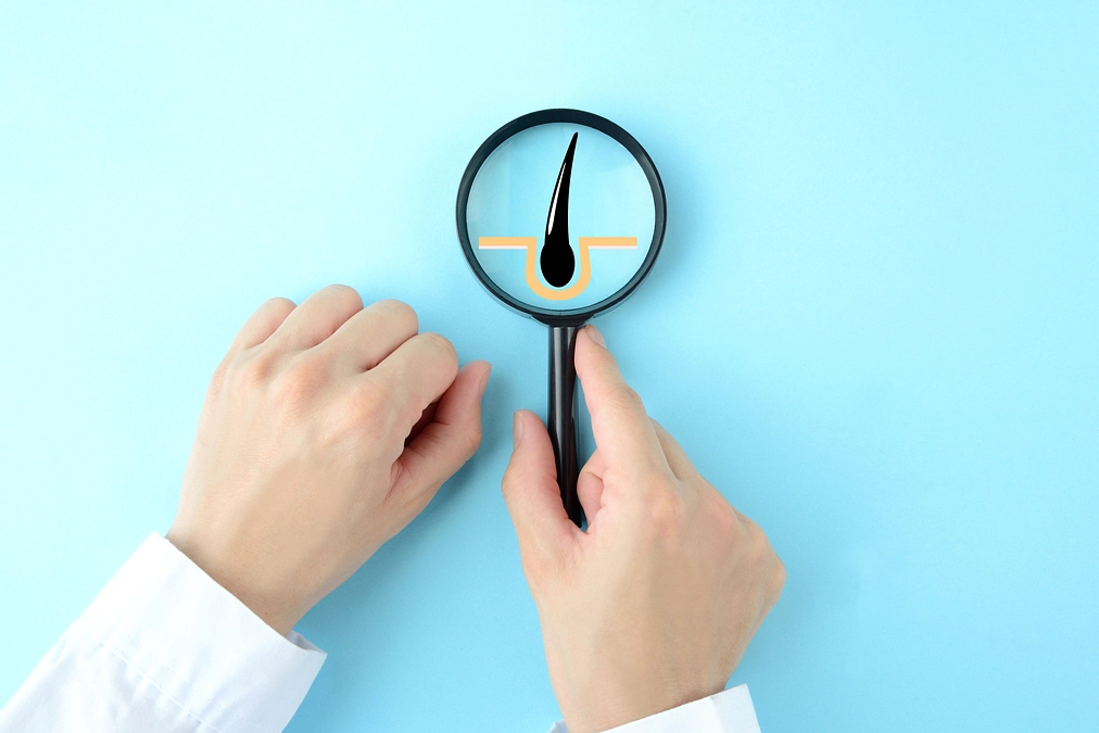 リターン紹介：毛髪ストレス分析