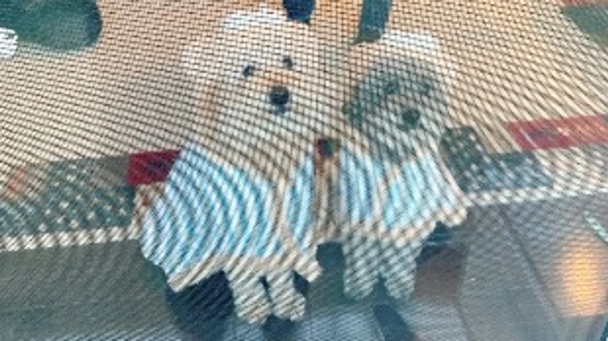 脾臓に腫れと石灰化が見つかってしまいました