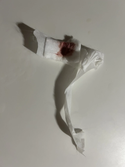 退院後の様子②