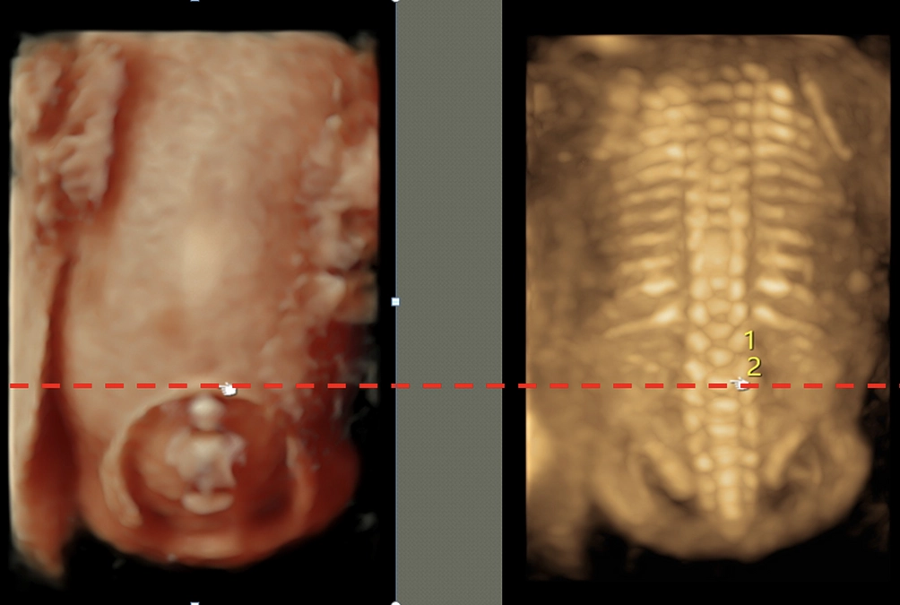 【情報⑤】胎児手術の術前準備
